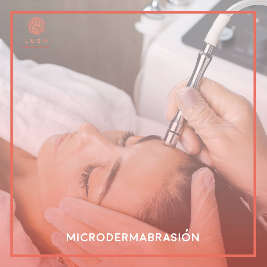 Microdermabrasión